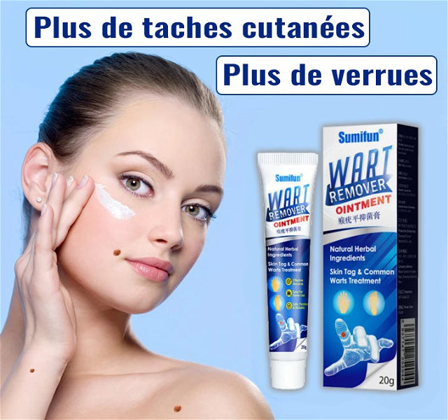 Crème médicale naturelle pour les verrues cutanées