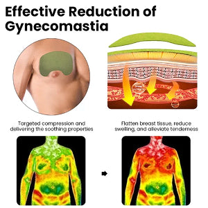 Patch de compresse pour gynécomastie Oveallgo™ TurmericMax