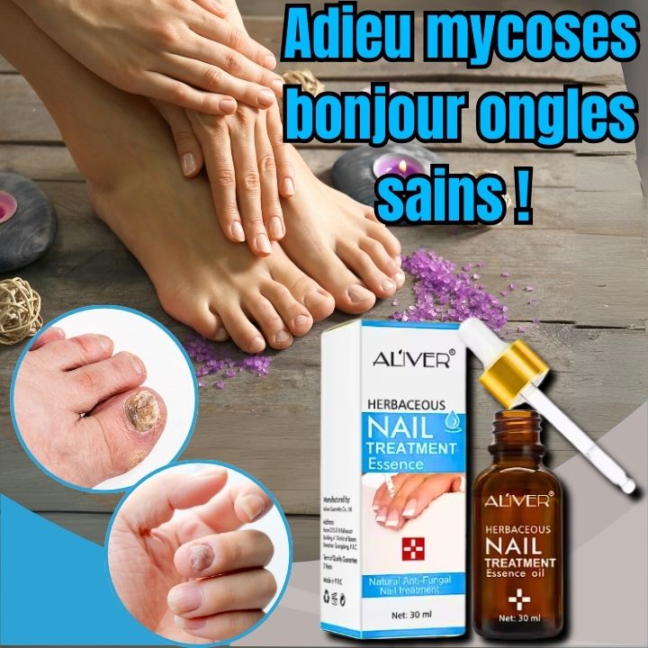 huile Essence de traitement des ongles à base de plante naturel